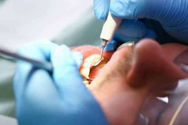 Best Pediatric Emergency Dentist in West Union, OH